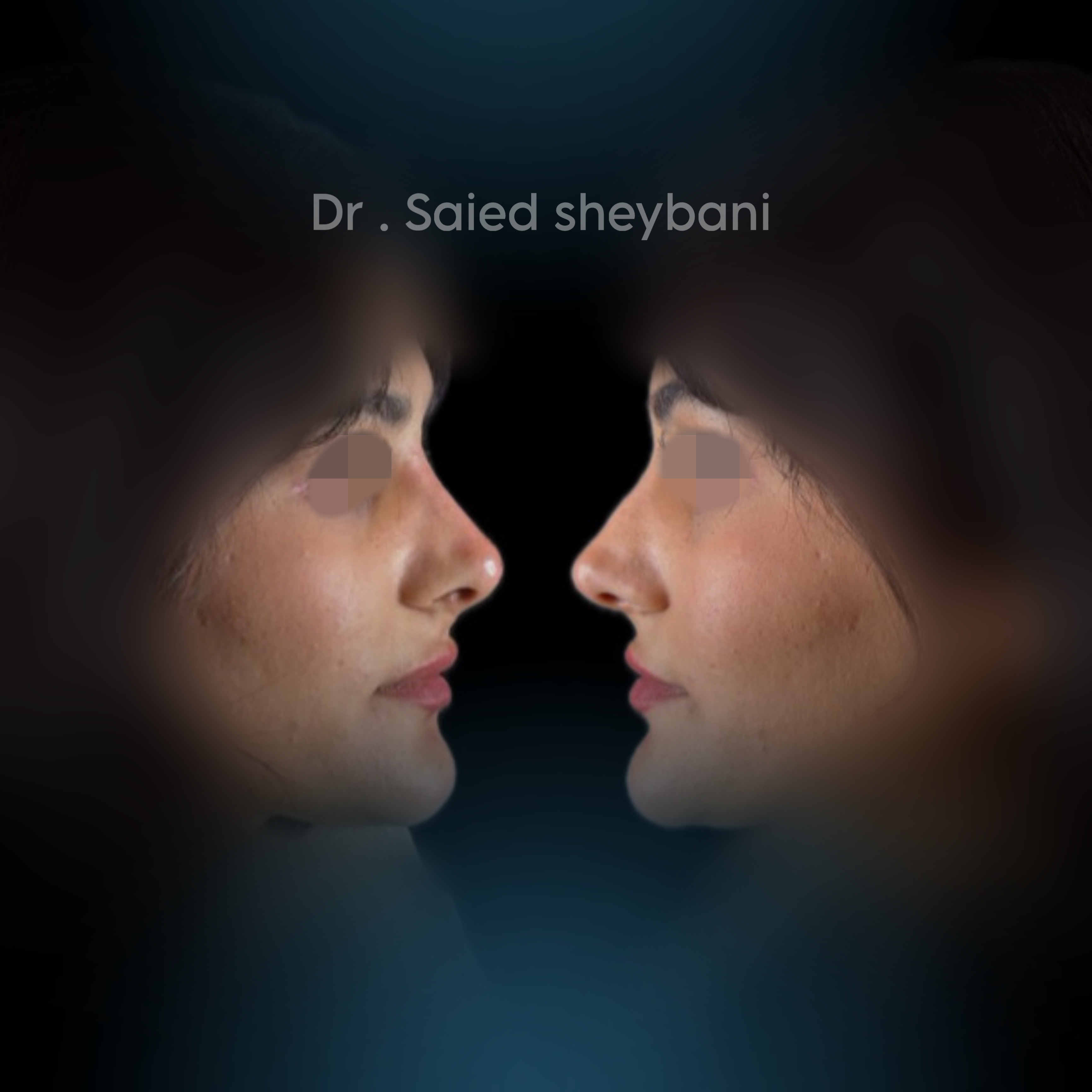 گالری Down Lift - تصویر 3