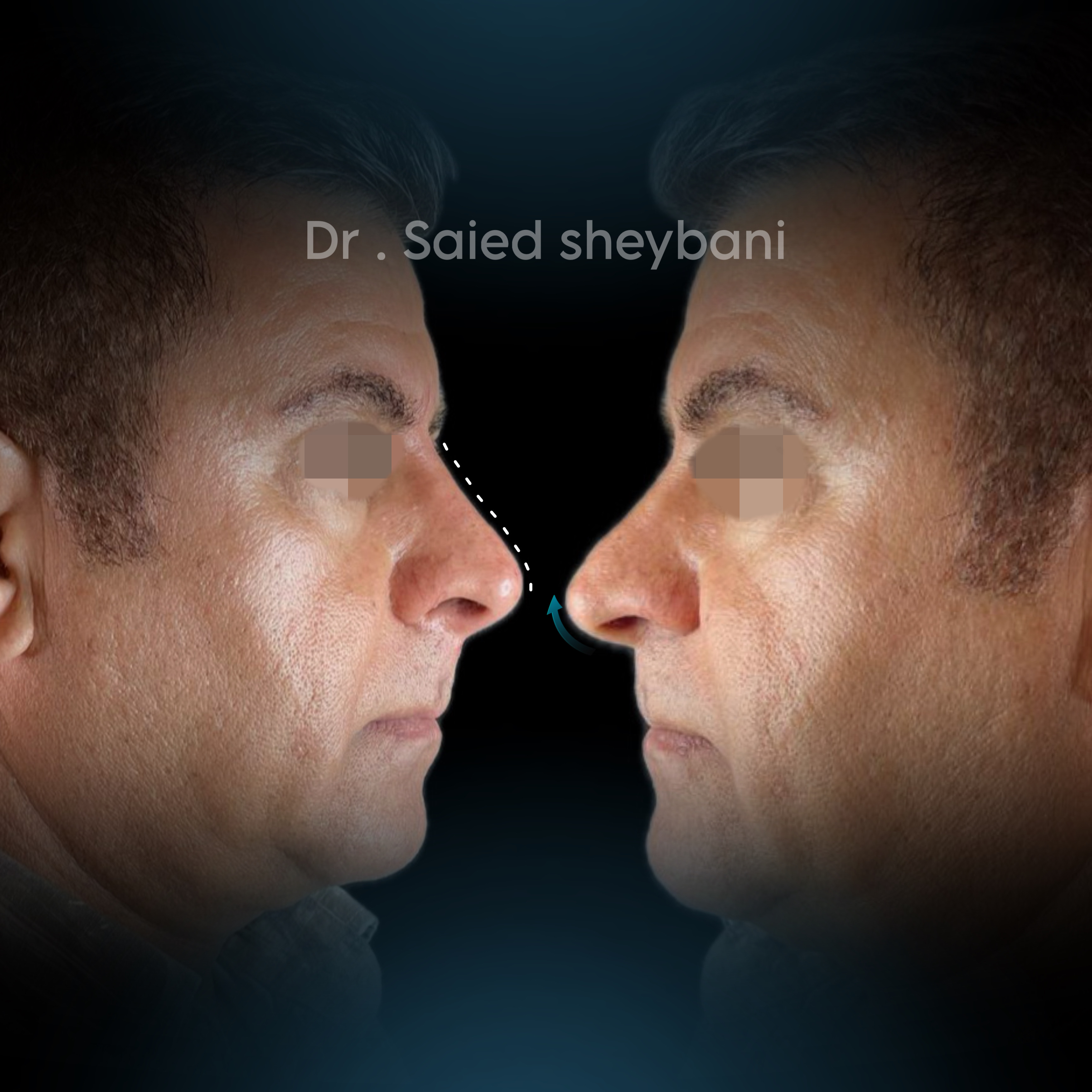 گالری Down Lift - تصویر 4